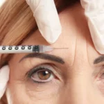 BOTOX Toxina Botulinica em braga