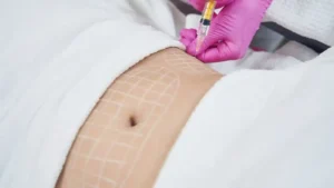 MESOTERAPIA corporal em braga
